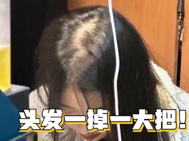 收集各类澳门彩资料的软件叫什么:因发量太多剃掉头发